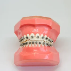 Witzig Sagittal (3-way expansion)