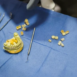 Immediate Tooth Additions