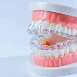 Essix retainer
