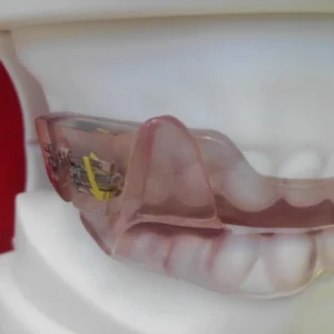 Sleep Apnea Device