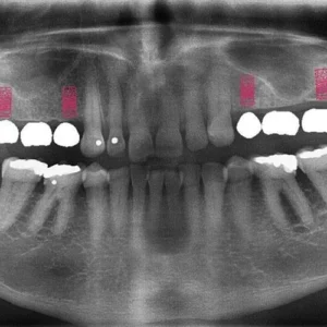 Radiograph Guide