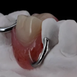 Clasps (S.S)