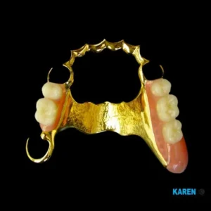 Gold Clasp